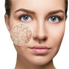 DRY SKIN