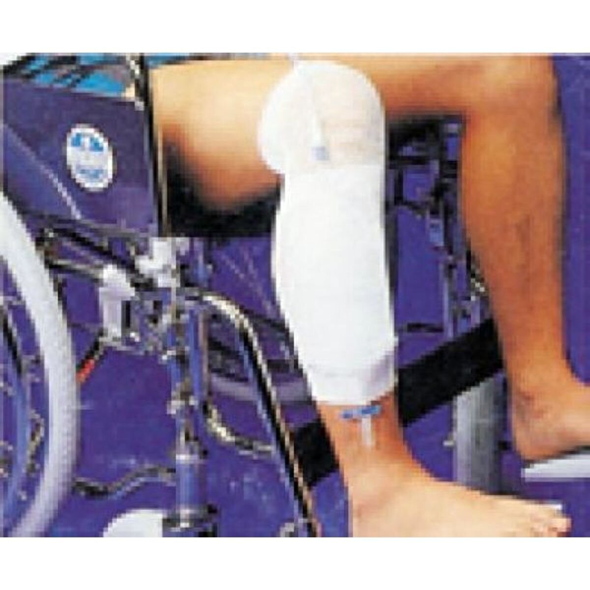 CATHETER FIXATION DEVICE M LEGGYFIX Medical Equipment Drainage & Tubing