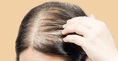 Fine Hair