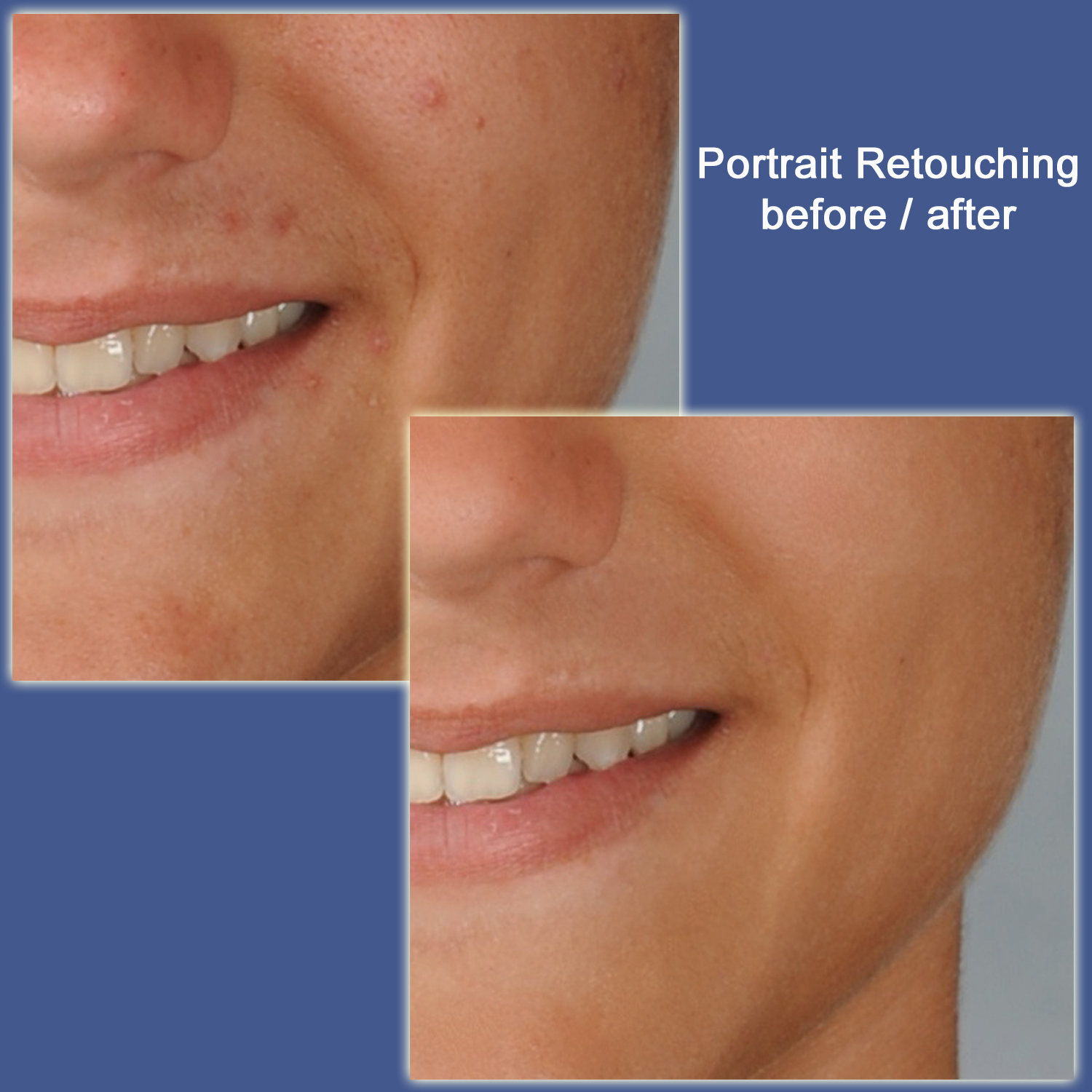 Facial Retouching