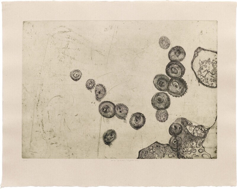 Prima Materia (Infected Cells) - Etching