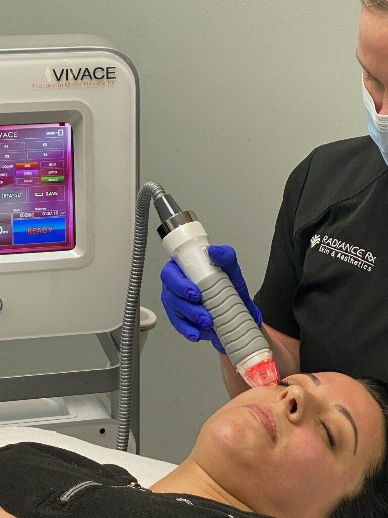 RF Microneedling for Face