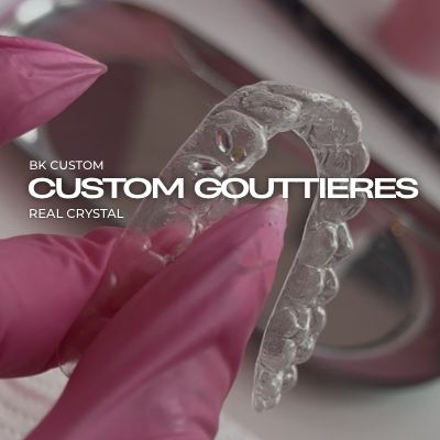 CUSTOM GOUTTIÉRES