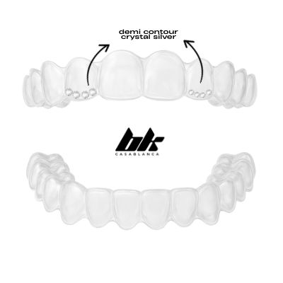 DOUBLE DEMI GEMS - CUSTOM GOUTTIÈRES