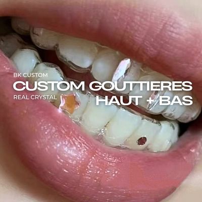 GOUTTIÈRES HAUT + BAS