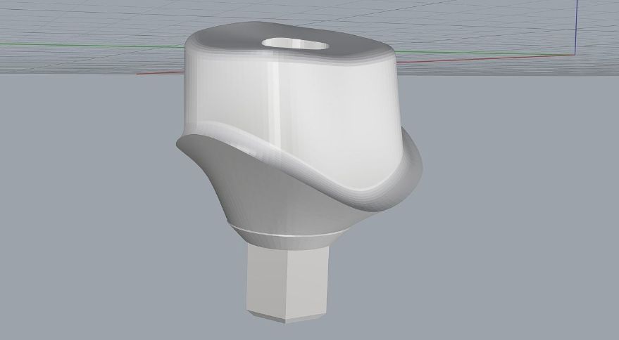 Custom Healing Abutment