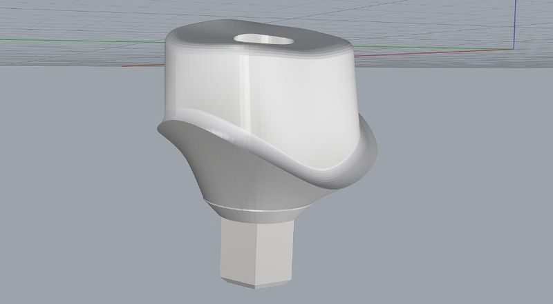 Custom Healing Abutment