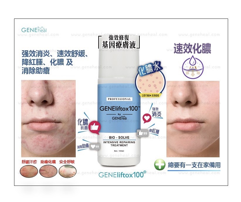 GENEheal Bio-Solve Intensive Repairing Treatment 「強效修復基因療膚液」Amber _ 推介