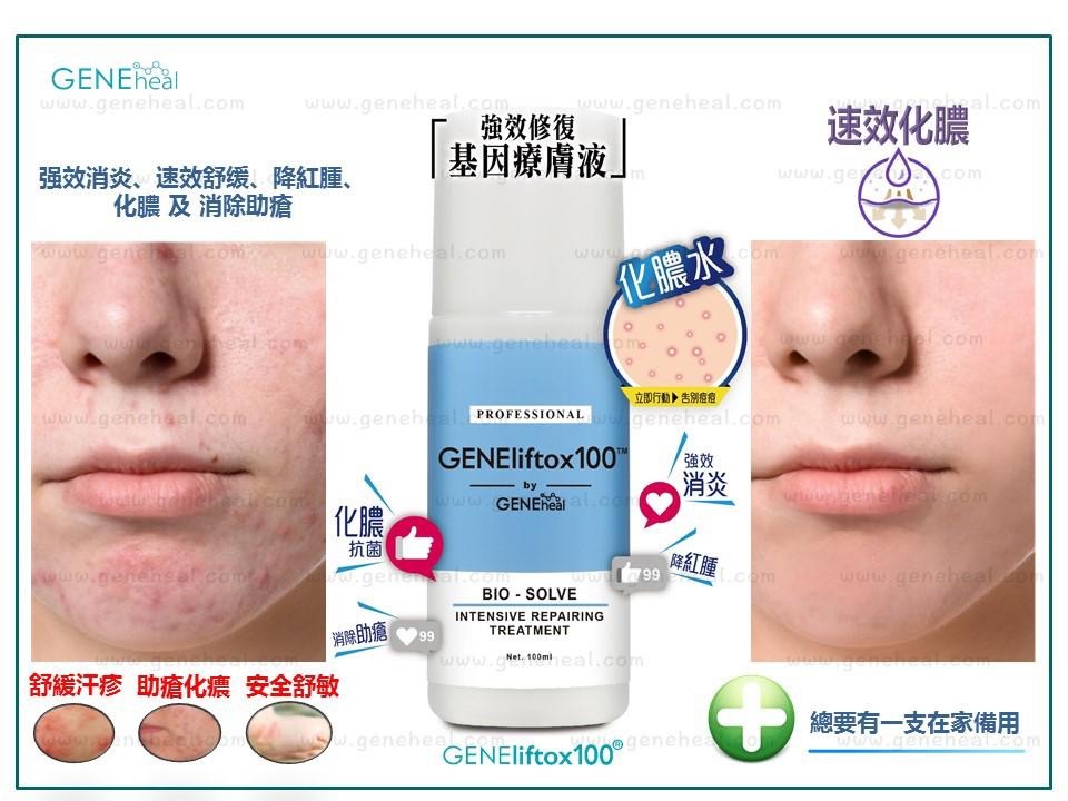 <軒仔推介> GENEheal Bio Intensive Repairing Treatment 「強效修復基因療膚液」