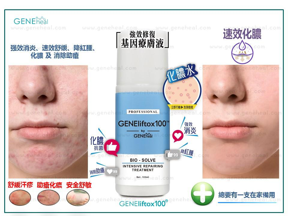 GENEheal Bio Intensive Repairing Treatment 「強效修復基因療膚液」《Roseann愛心推介》