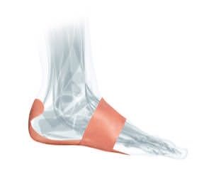 Mueller PF Tape for Plantar Fasciitis