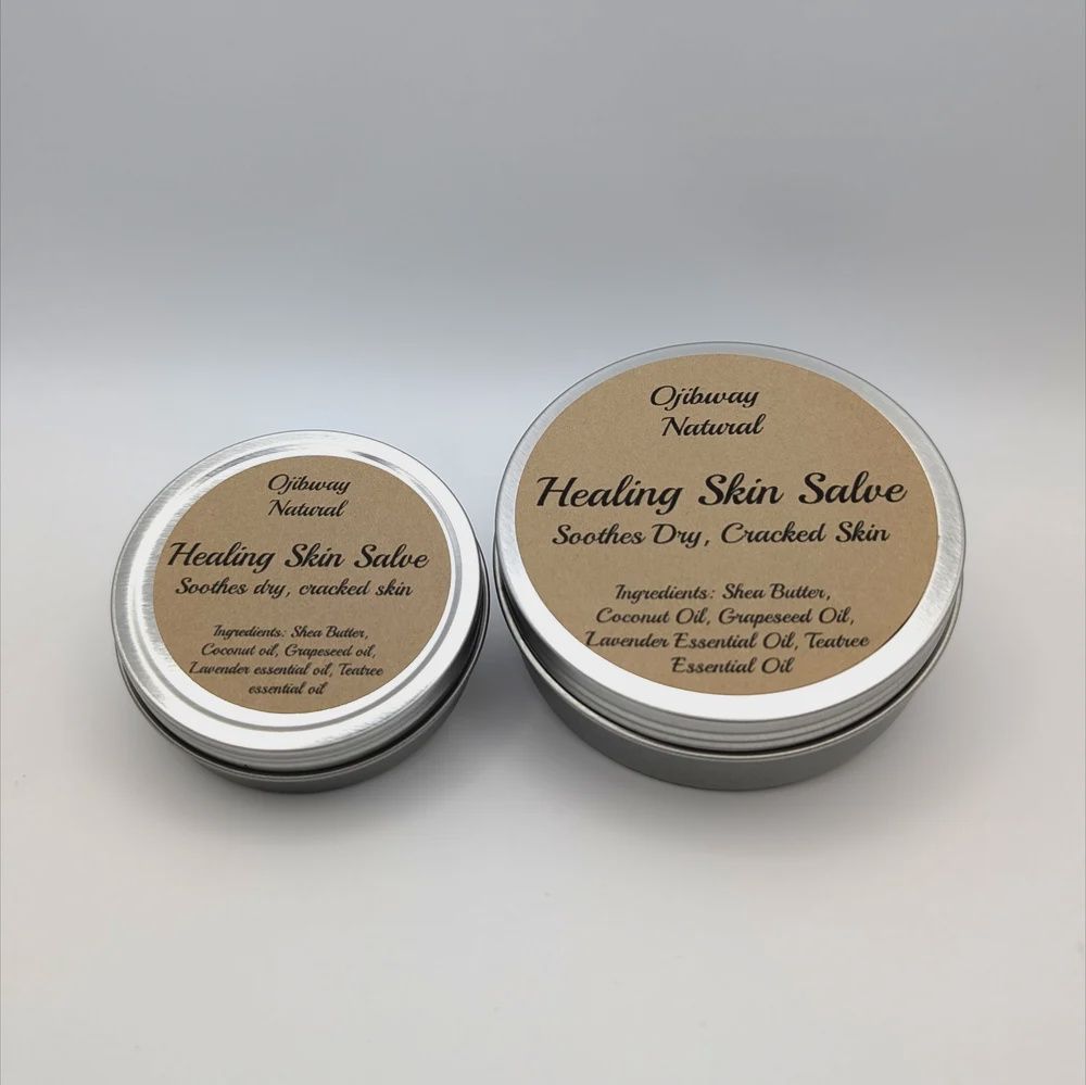 Healing Skin Salve, Size: 2oz
