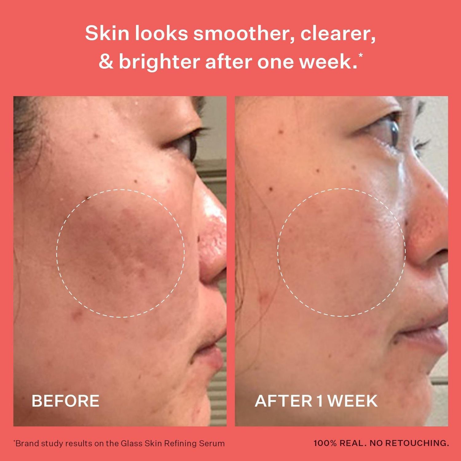 Peach &amp; Lily Glass Skin Discovery Kit