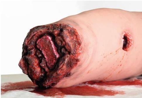 Jambe d'entraînement au contrôle des hémorragies peau claire 3B SCIENTIFIC