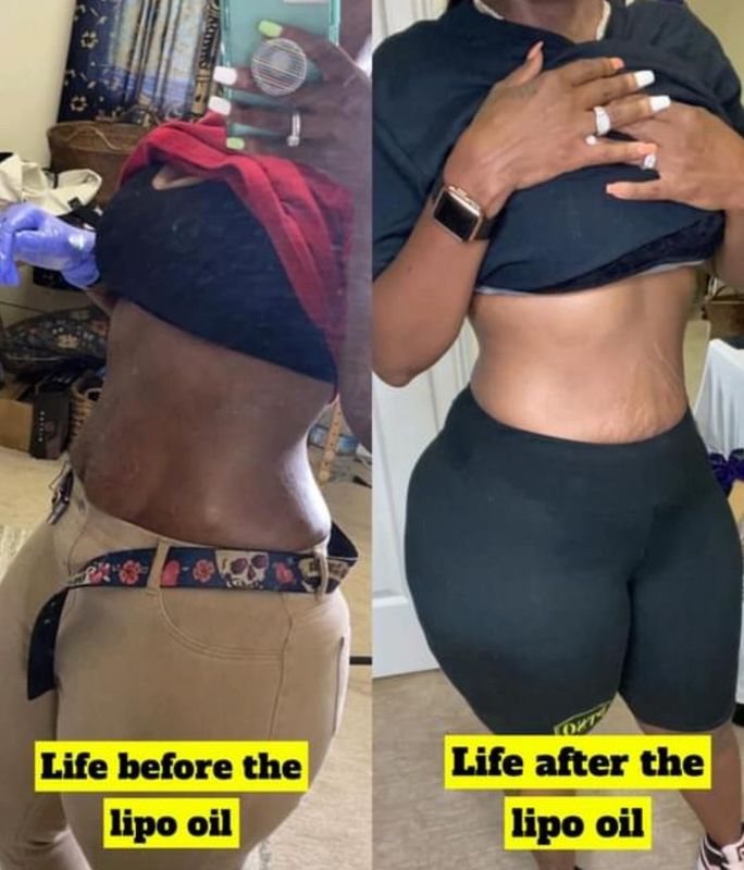 Lipo Slimming Oil ( inch Loss)