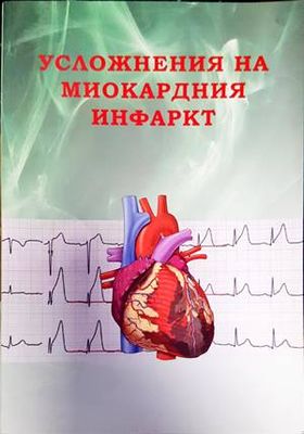 Усложнения на миокардния инфаркт