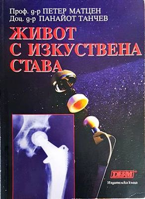 Живот с изкуствена става