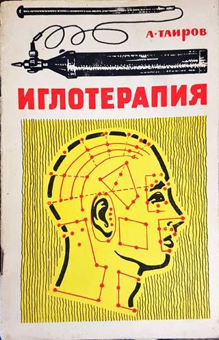 Иглотерапия