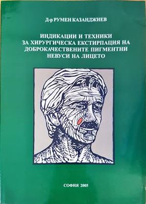 Индикации и техники за хирургическа екстирпация на доброкачествените пигментни невуси на лицето
