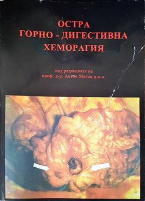 Остра горно-дигестивна хеморагия