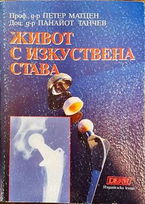 Живот с изкуствена става