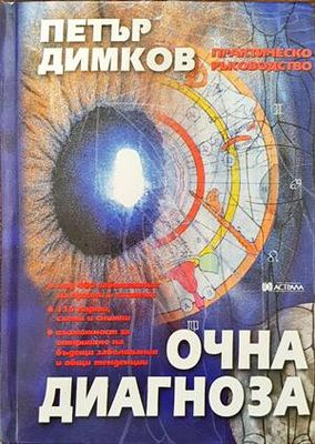 Очна диагноза
