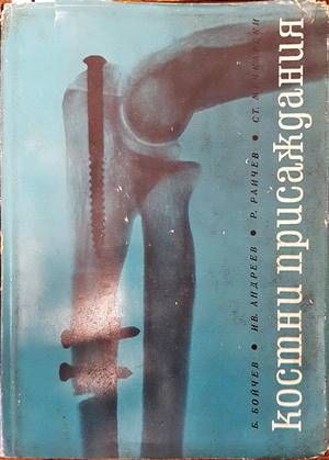 Костни присаждания