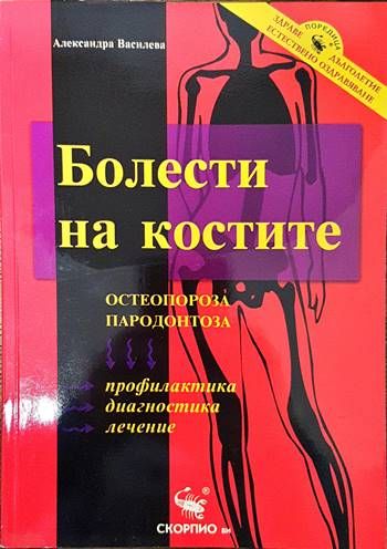 Болести на костите: Остеопороза, пародонтоза Болести на костите: Остеопороза, пародонтоза