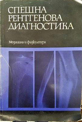 Спешна рентгенова диагностика