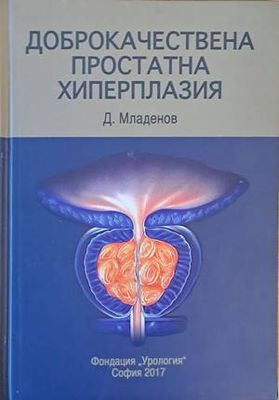 Доброкачествена простатна хиперплазия