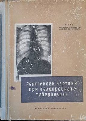 Рентгенови картини при белодробната туберкулоза