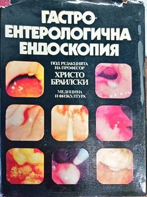 Гастроентерологична ендоскопия