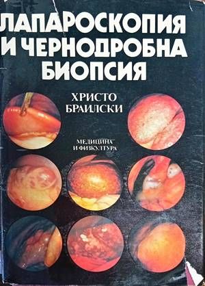 Лапароскопия и чернодробна биопсия