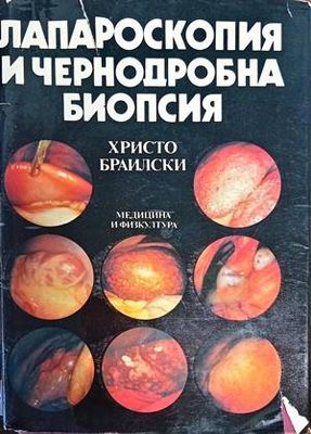 Лапароскопия и чернодробна биопсия