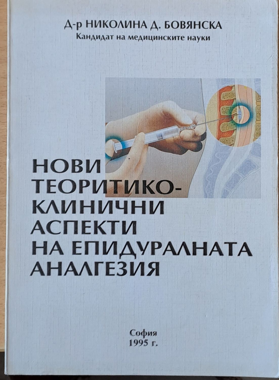 Нови теоритико-клинични аспекти на епидуралната аналгезия