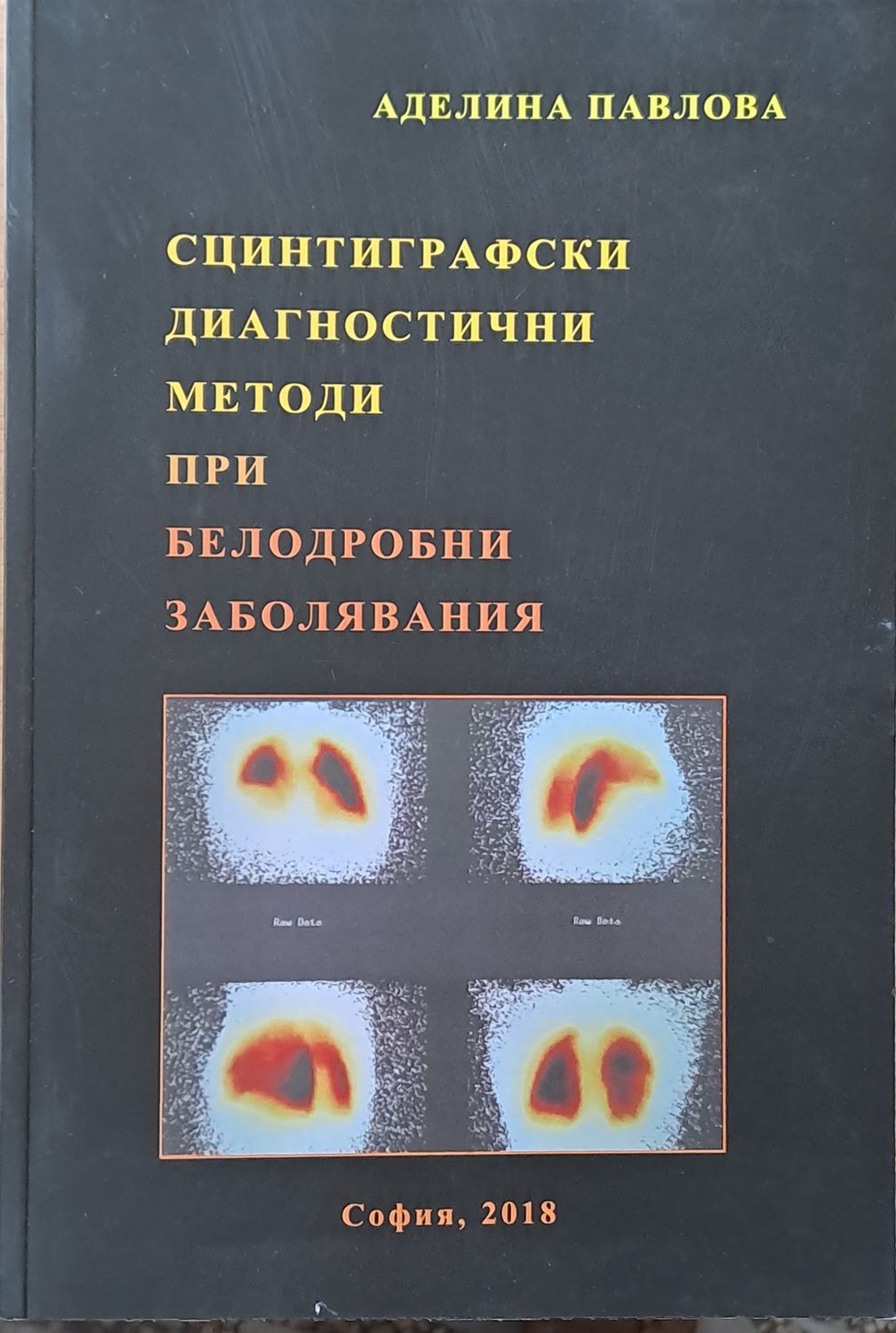 Сцинтиграфски диагностични методи при белодробни заболявания Сцинтиграфски диагностични методи при белодробни заболявания