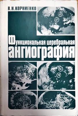 Функциональная церебральная ангиография