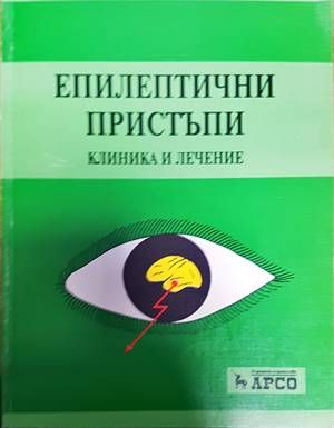 Епилептични пристъпи: Клиника и лечение