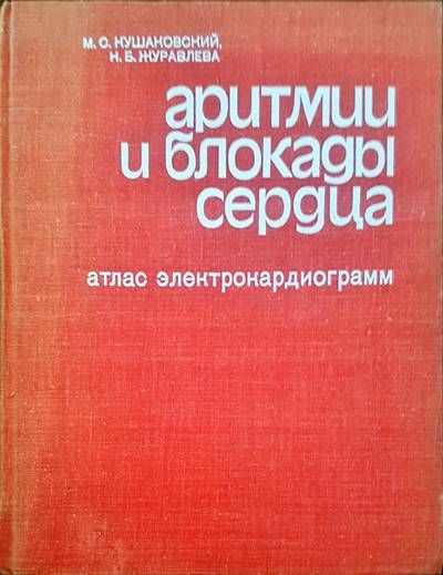 Аритмии и блокады сердца. Атлас электрокардиограмм Аритмии и блокады сердца. Атлас электрокардиограмм