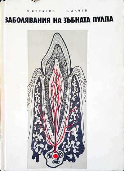 Заболявания на зъбната пулпа