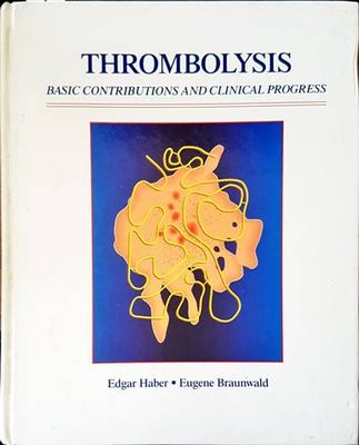 Thrombolysis