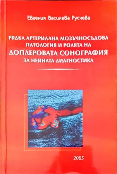 Рядка артериална мозъчносъдова патология и ролята на доплеровата сонография за нейната диагностика
