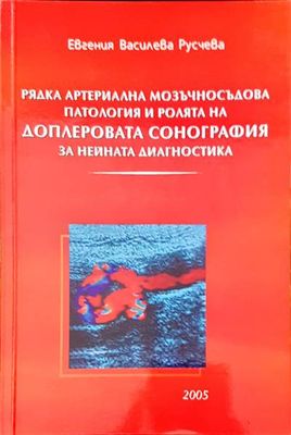 Рядка артериална мозъчносъдова патология и ролята на доплеровата сонография за нейната диагностика