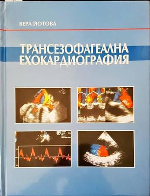 Трансезофагеална ехокардиография