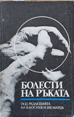 Болести по ръката