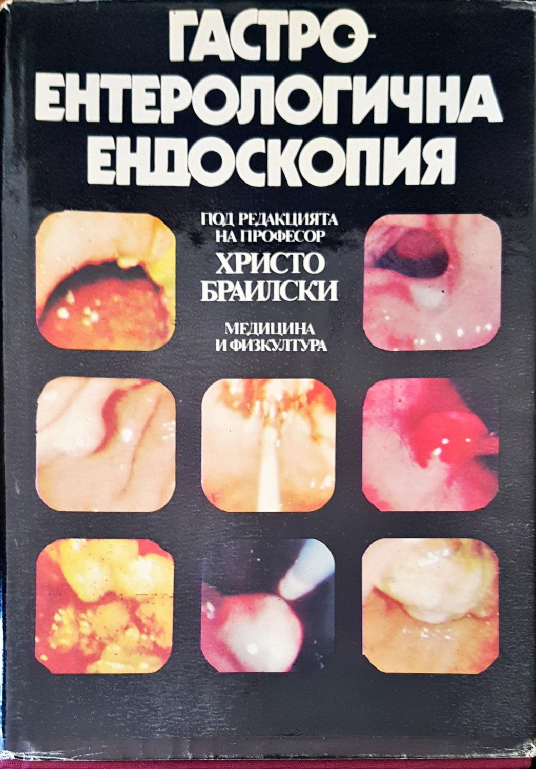 Гастро ентерологична ендоскопия