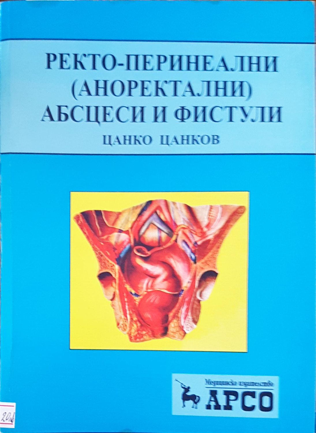Ректо-перинеални абсцеси и фистули