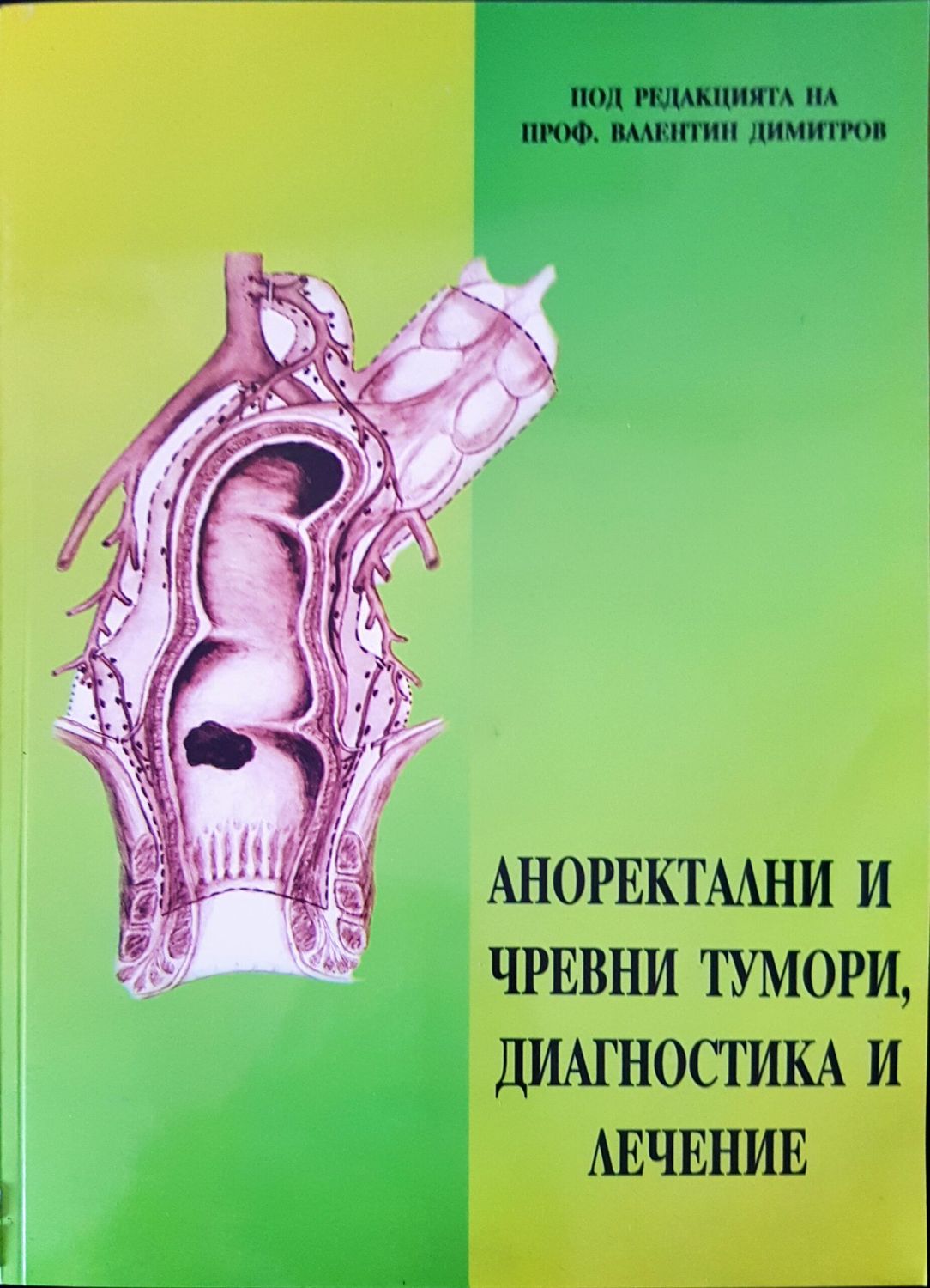 Аноректални и чревни тумори, диагностика и лечение