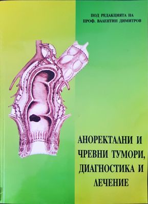 Аноректални и чревни тумори, диагностика и лечение