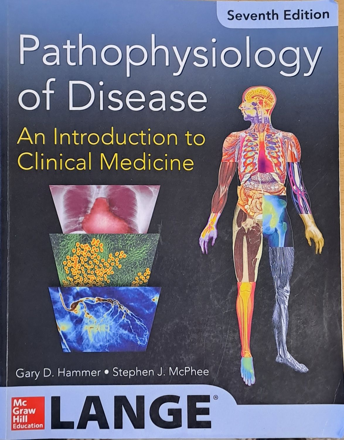 Pathophysiology of Disease